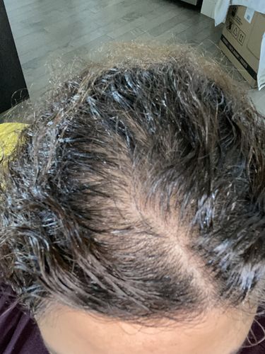 Customer photo review of Growth & Shine Hair Oil