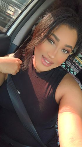 Customer photo review of Neala Green Contact Lenses(12 months wear)