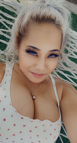 Customer photo review of Wildcat Blue Prescription Contact Lenses