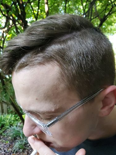 Customer photo review of Serum Concentrate Kit