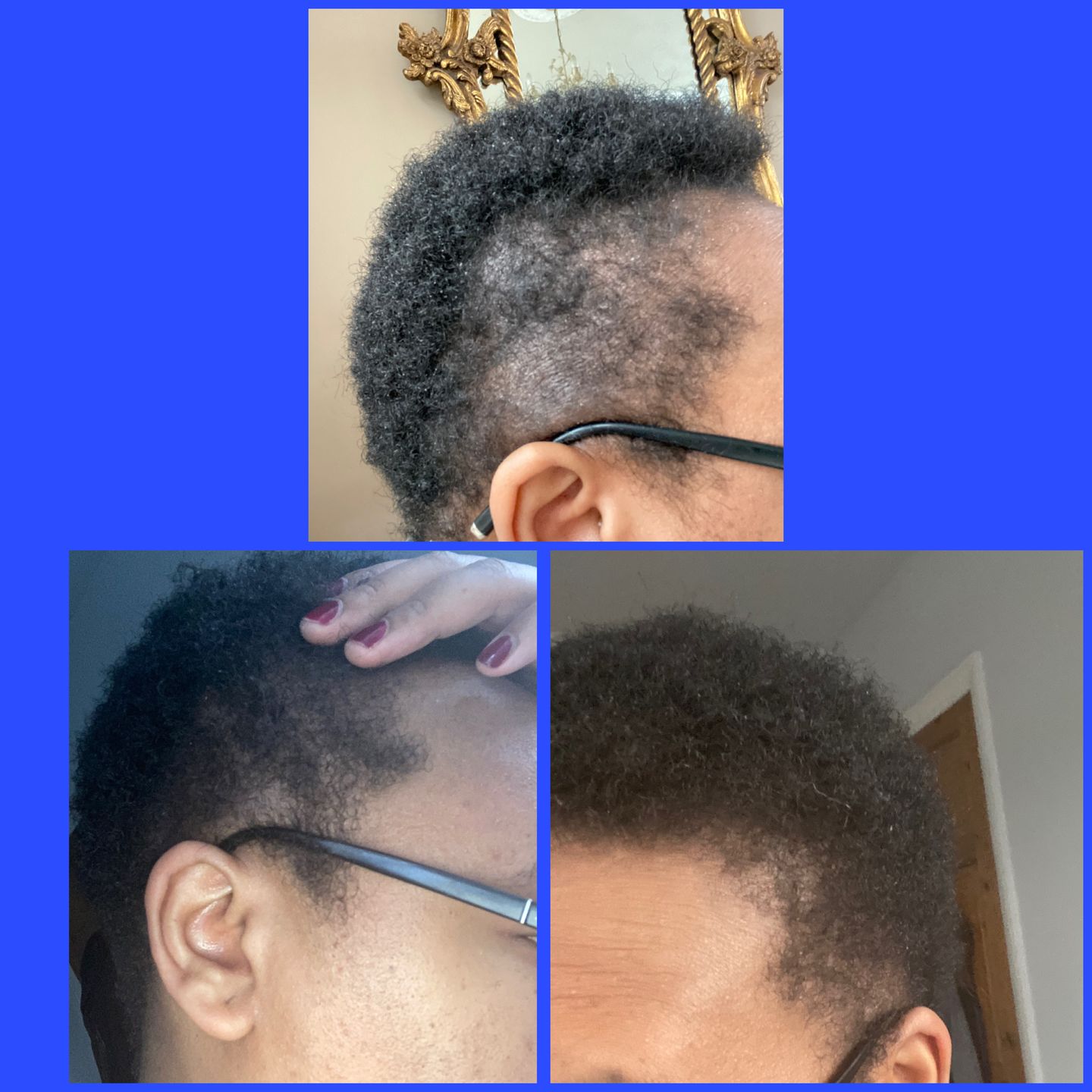 Customer photo review of The Staple Remedy Herbal Growth Oil