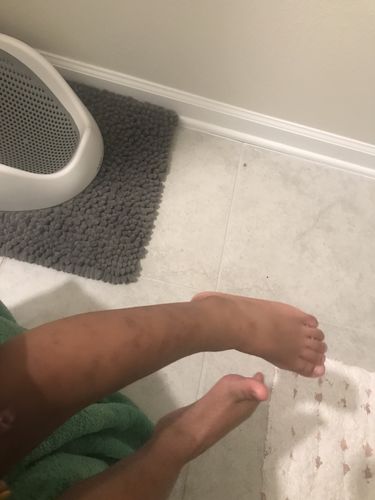 Customer photo review of Ringworm Control