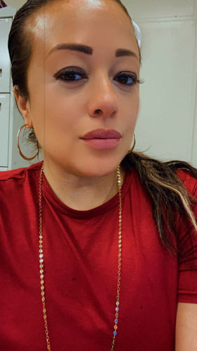 Customer photo review of LipFix: Lip Flip