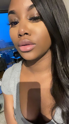 Customer photo review of LipFix: Filler