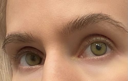 Customer photo review of Crystal Green Contact Lenses(12 months wear)