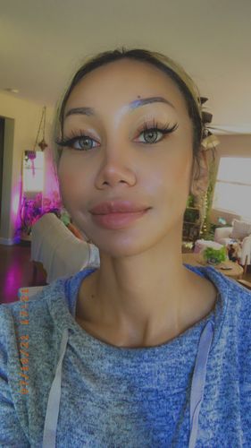 Customer photo review of Neala Green Contact Lenses(12 months wear)