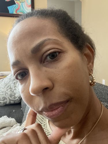 Customer photo review of Neala Green Contact Lenses(12 months wear)
