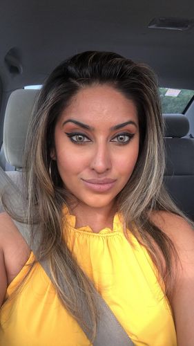 Customer photo review of Citha Hazel Contact Lenses(12 months wear)