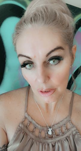 Customer photo review of Cherry Ocean Prescription Contact Lenses