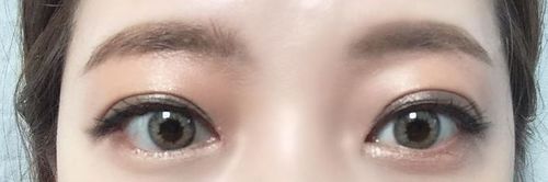 Customer photo review of Mix Ann Hawaiian Gray (2pcs) (Silicone Hydrogel) ( Buy 1 Get 1 Free ) 1Monthly G.DIA 12.0mm