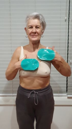 Customer photo review of LymFATics Special Bundle