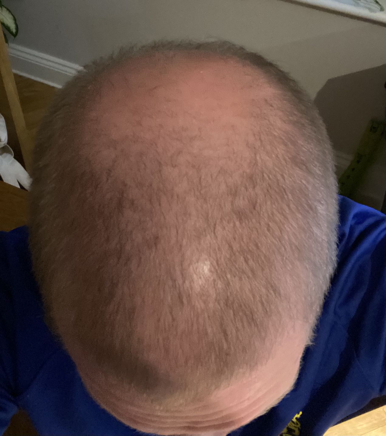 Customer photo review of Scalp Oil
