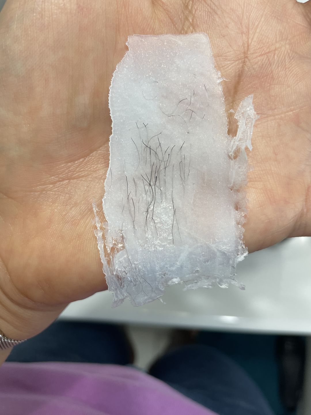 Customer photo review of At-Home Signature Series Hair Removal Wax