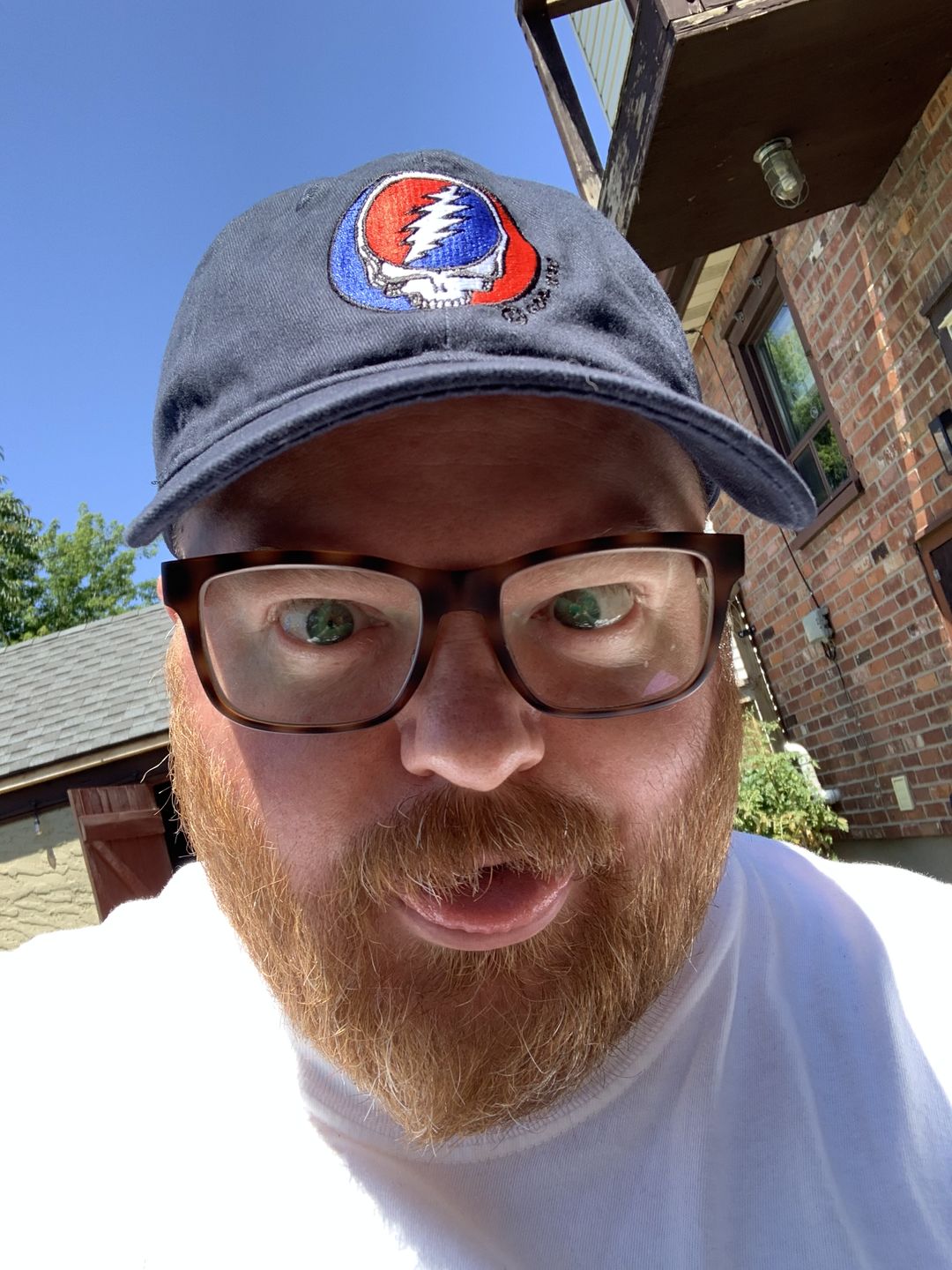 Customer photo review of Grateful Dead Steal Your Face Cap