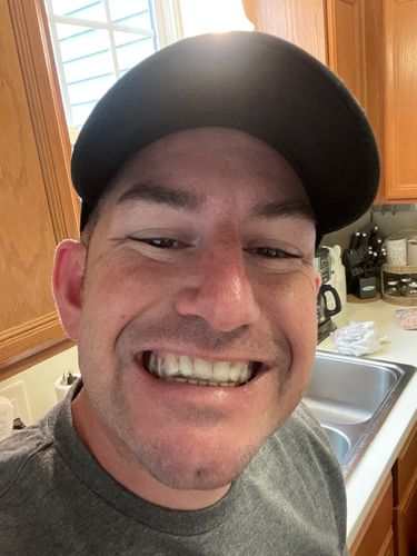 Customer photo review of 𝗔𝗣𝗘𝗫™ 𝗟𝗶𝘁𝗲