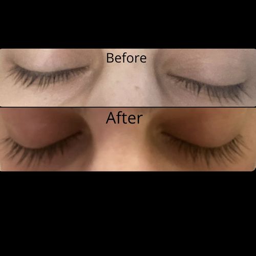 Customer photo review of Eyelash Enhancing Serum