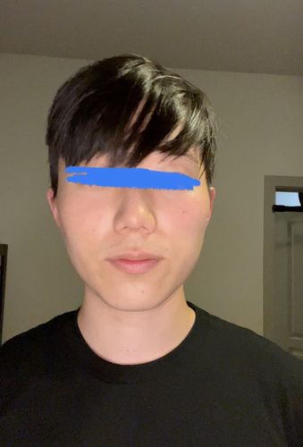 Customer photo review of Serum Concentrate Kit