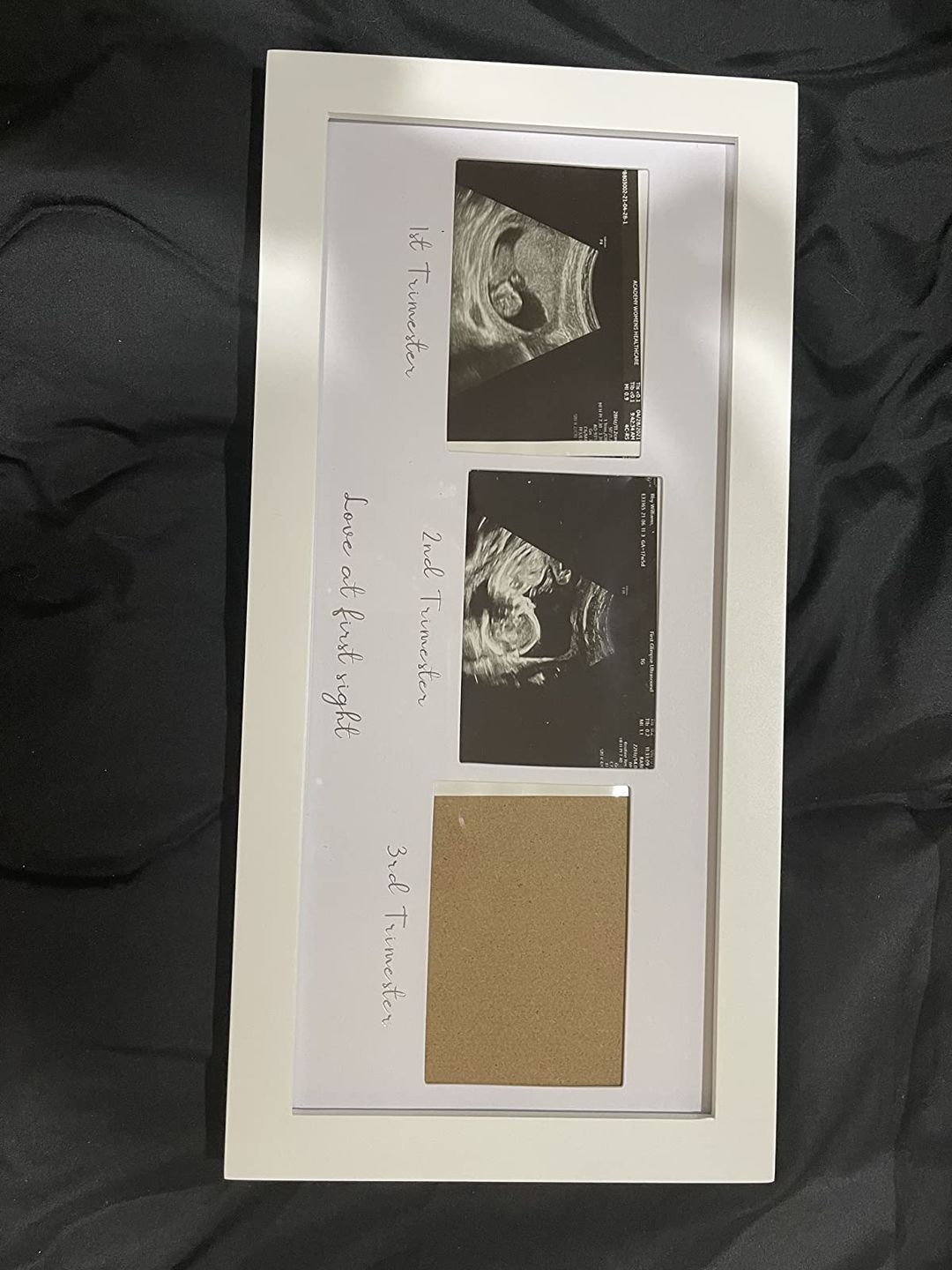 Customer photo review of TRIO Sonogram Frame