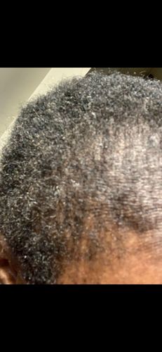 Taiwo A. review of India’s Secret Ancient Ayurvedic Hair Follicle Elixir (3 sizes) image 1 out of 1