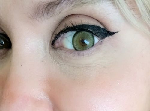 Customer photo review of Norko Green Contact Lenses(12 months wear)