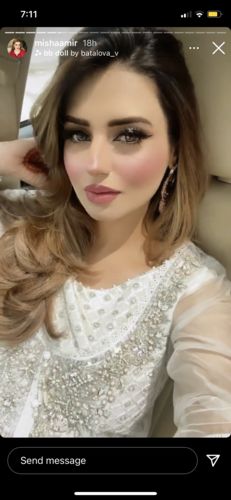 Customer photo review of CurlME Detachable Hair Brush Starter Set - 6 Brush Barrels