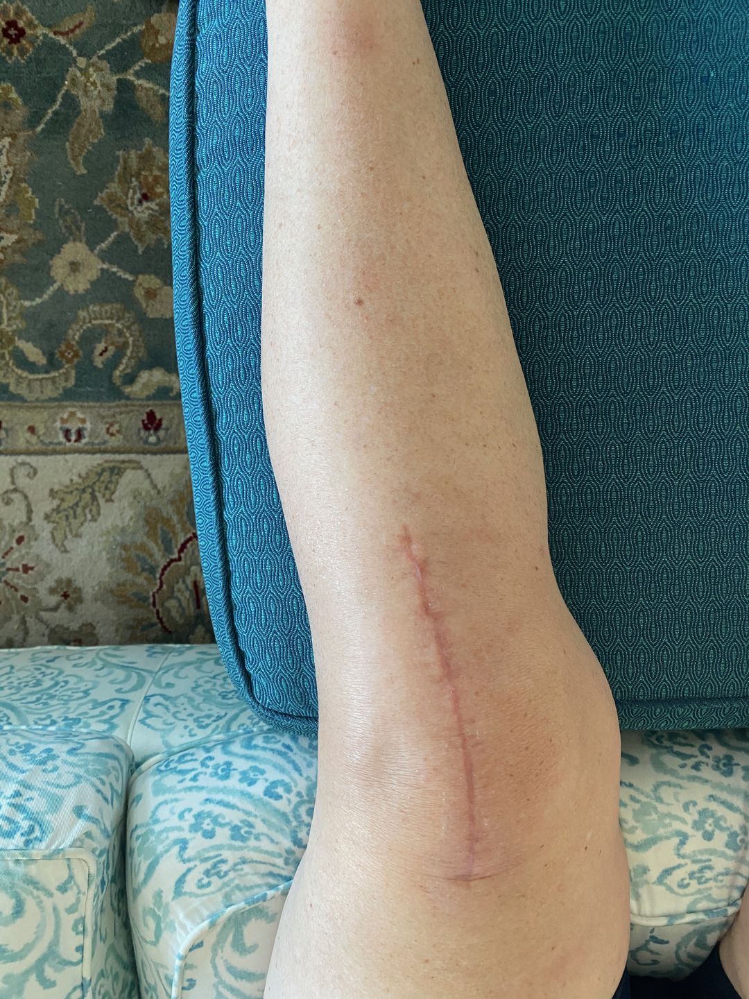 Customer photo review of Combat Ready Ointment - Triple Threat