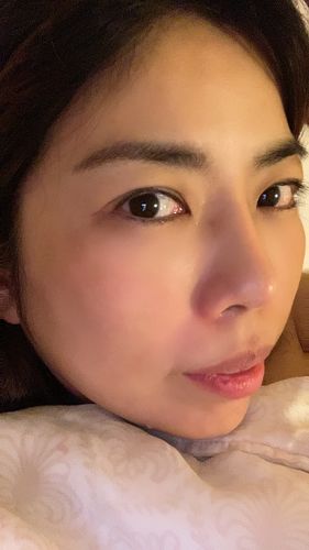 Customer photo review of TriPollar STOP Vx