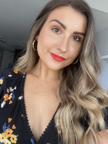 Customer photo review of Freckle Stain