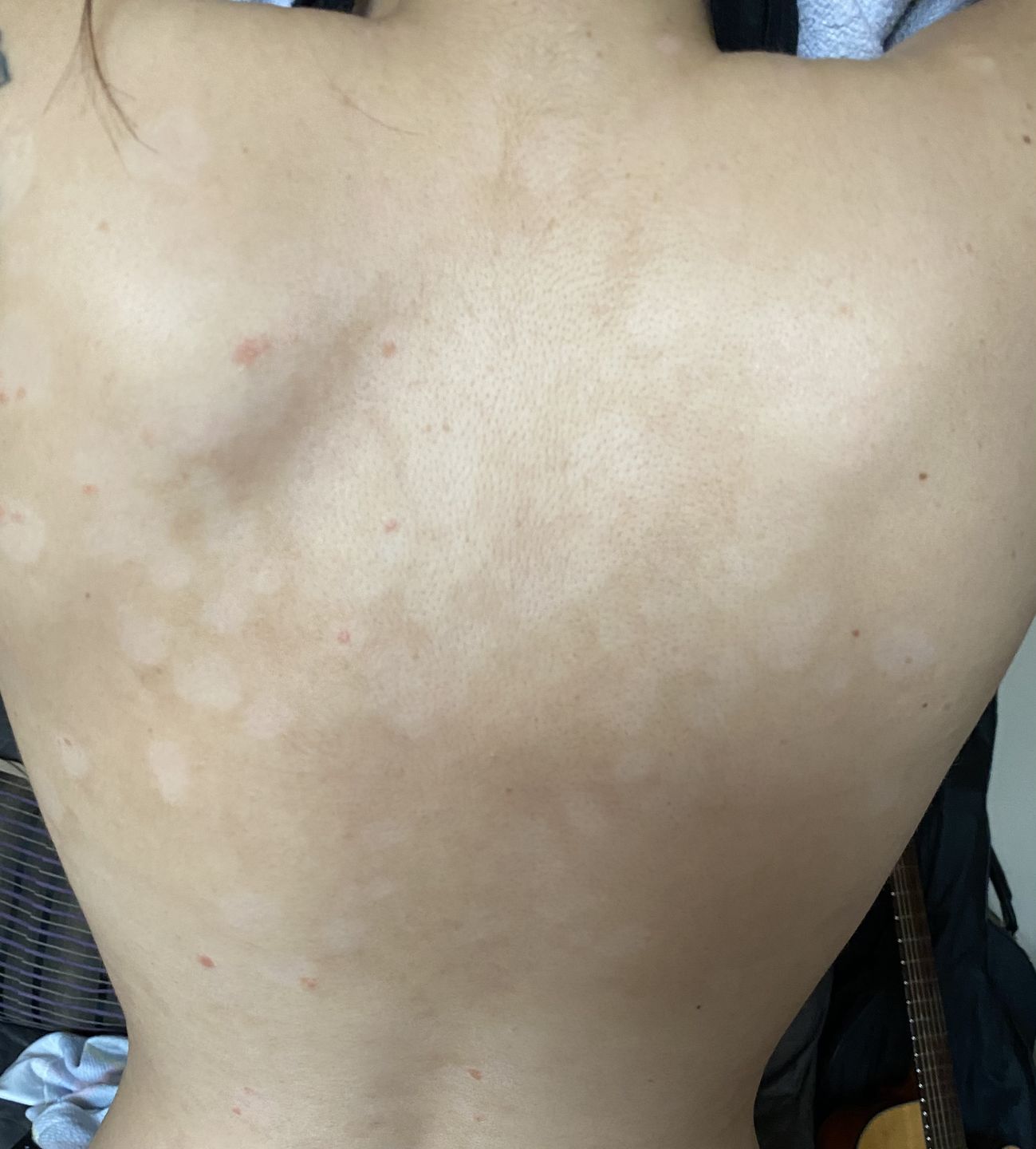 Customer photo review of Skin Saviour Balm