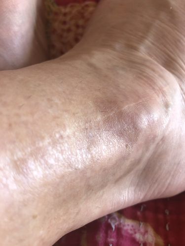 Customer photo review of Joint Pain Management