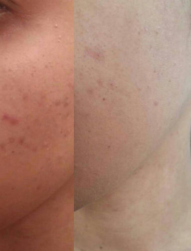 Customer photo review of Sleek Skin Serum 30ml