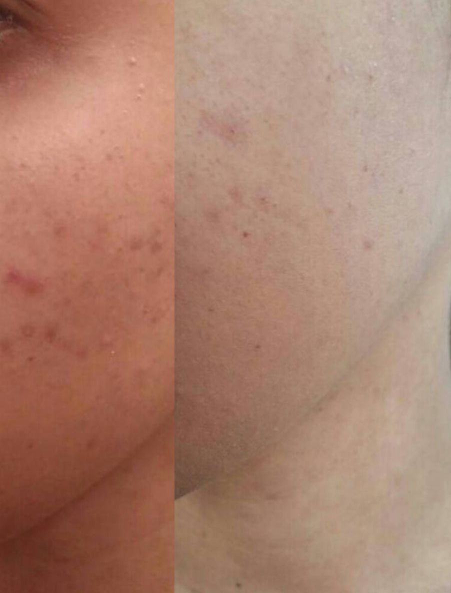 Customer photo review of Sleek Skin Serum 30ml