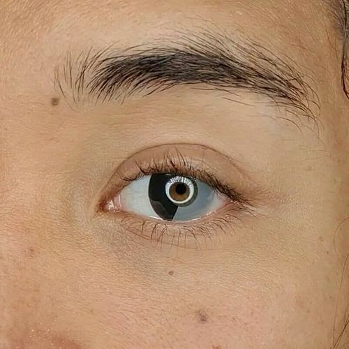 Customer photo review of Icoloured®  Mind Split Black-White Colored Contact Lenses