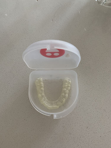 Customer photo review of Night Guard - Yearly