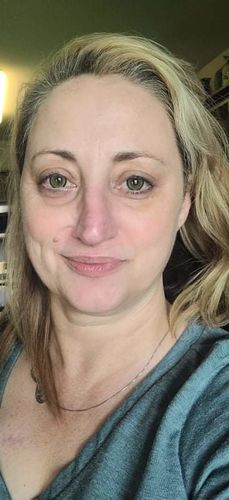 Customer photo review of Norko Green Contact Lenses(12 months wear)