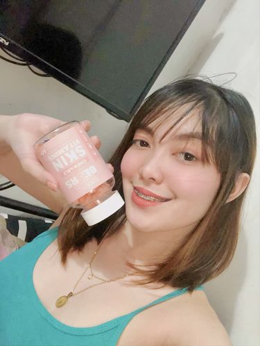 Customer photo review of Skin Vitamin Gummies
