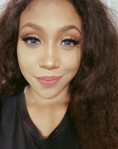 Customer photo review of Norko Blue Contact Lenses(12 months wear)