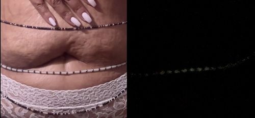 Customer photo review of Iridescent Glow in the Dark Waist Beads