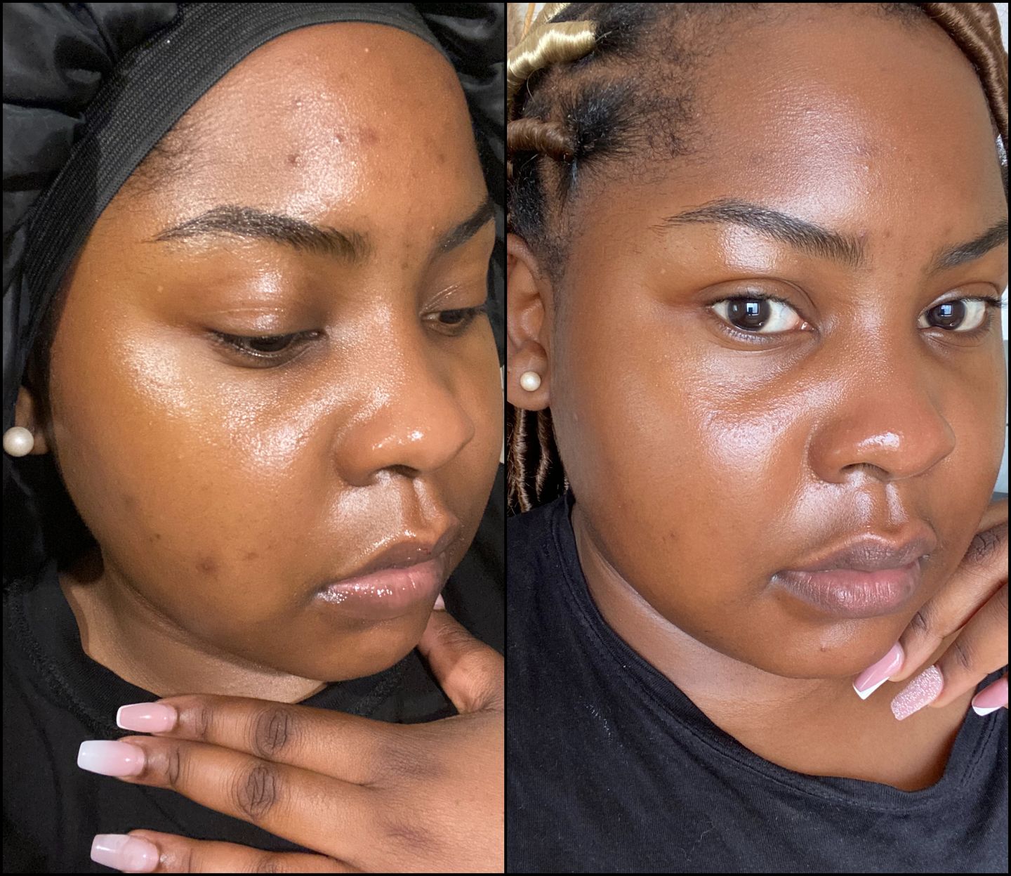 Customer photo review of HYPER G[L]O - Renewing Night Serum