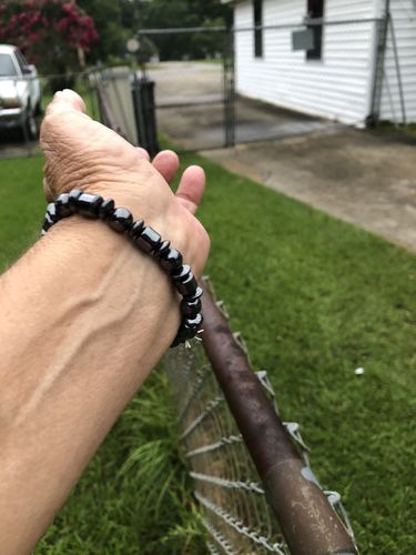 Customer photo review of Weight Loss Black Stone Magnetic Therapy Bracelet