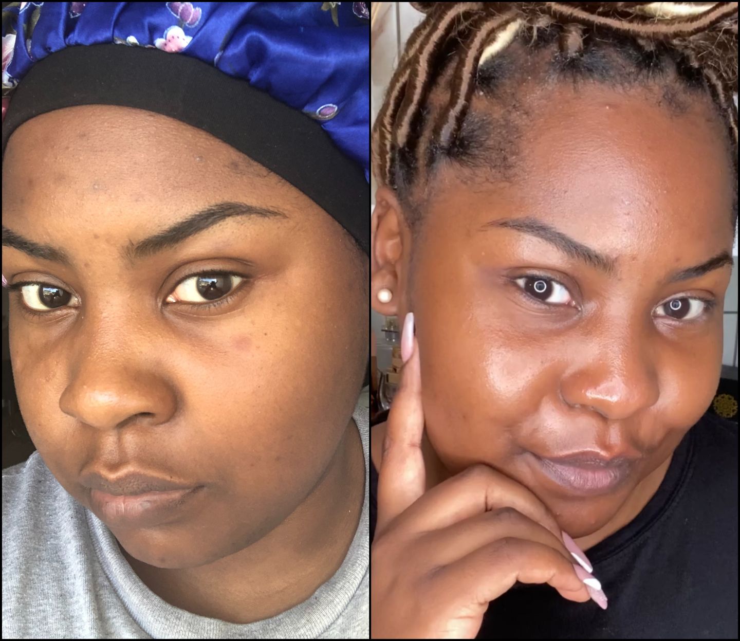 Customer photo review of SHEA DUO