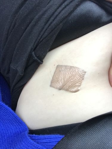 Customer photo review of Ultimate Mood Patch - MONTH SUPPLY Supply Homeopathic Skin Patches NEW & IMPROVED
