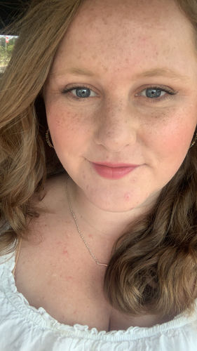 Customer photo review of Freckle Stain