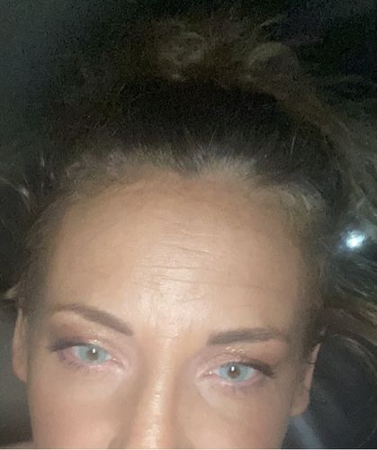 Customer photo review of [US Warehouse] Topaz Prescription Colored Contact Lenses