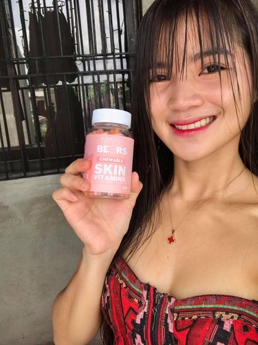 Customer photo review of Skin Vitamin Gummies