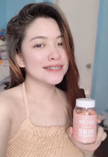 Customer photo review of Skin Vitamin Gummies