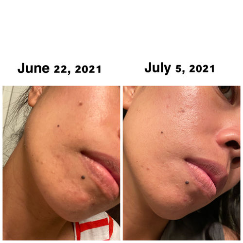 Customer photo review of Decalt