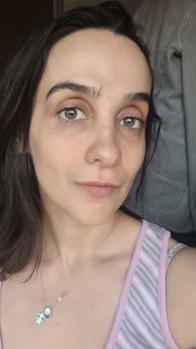 Customer photo review of 5-Step Clear Skin Kit