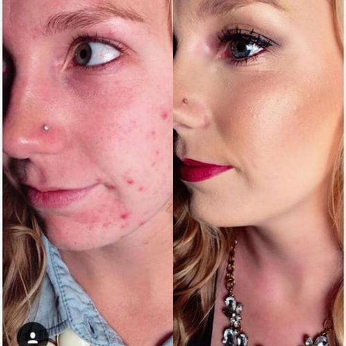 Sanelya® CC Crème Ultra Couvrante Toutes Carnations