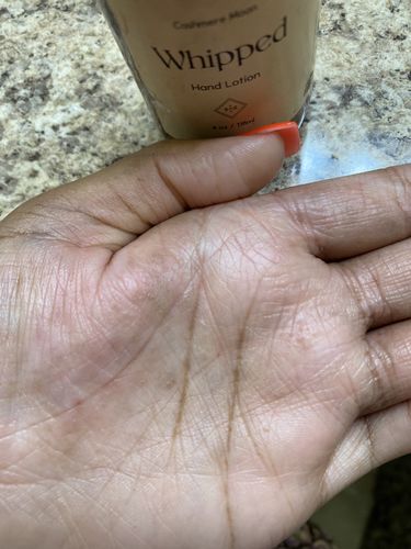 Customer photo review of Ultra-Hydration Whipped Hand Lotion